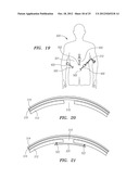 DEVICES AND METHODS FOR LAPAROSCOPIC HERNIA REPAIR diagram and image