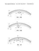 DEVICES AND METHODS FOR LAPAROSCOPIC HERNIA REPAIR diagram and image