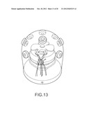 ARTHROSCOPIC TECHNIQUE FOR LOAD SHARING WITH PATCH AND SUTURE ASSEMBLY diagram and image