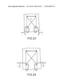 ARTHROSCOPIC TECHNIQUE FOR LOAD SHARING WITH PATCH AND SUTURE ASSEMBLY diagram and image