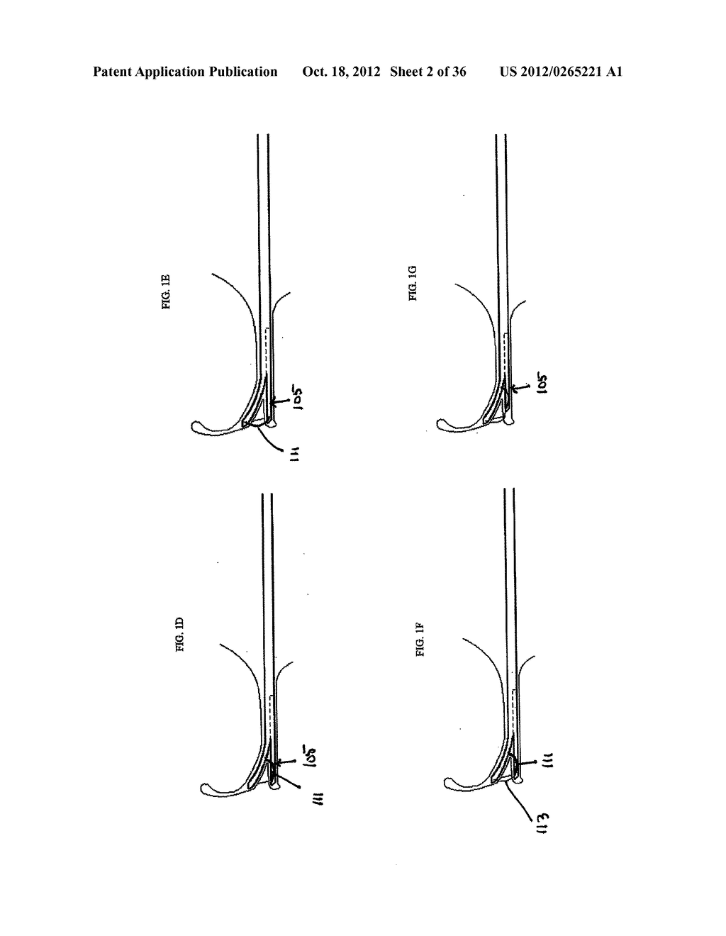 DEVICES, SYSTEMS AND METHODS FOR MENISCUS REPAIR - diagram, schematic, and image 03