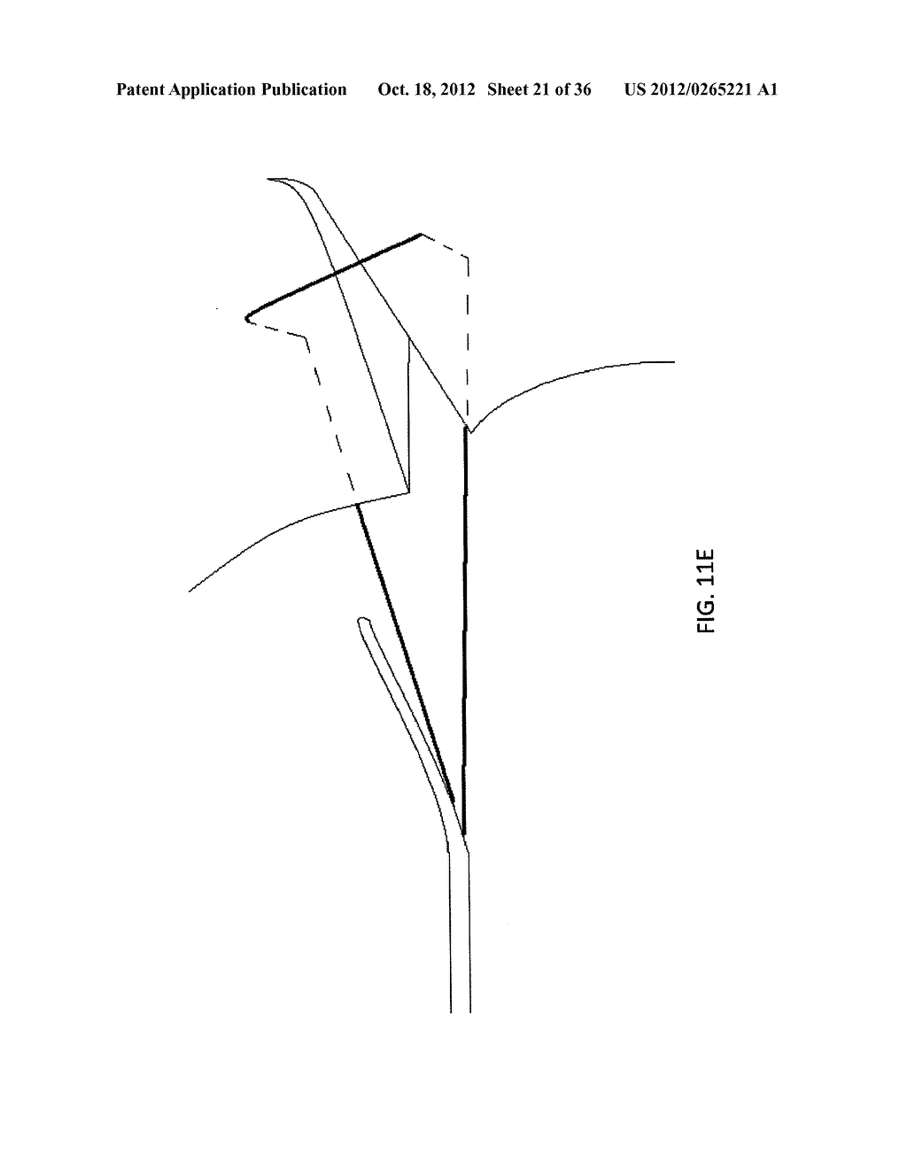 DEVICES, SYSTEMS AND METHODS FOR MENISCUS REPAIR - diagram, schematic, and image 22