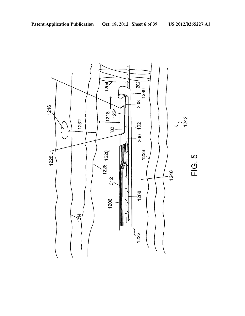 TISSUE TREATMENT - diagram, schematic, and image 07