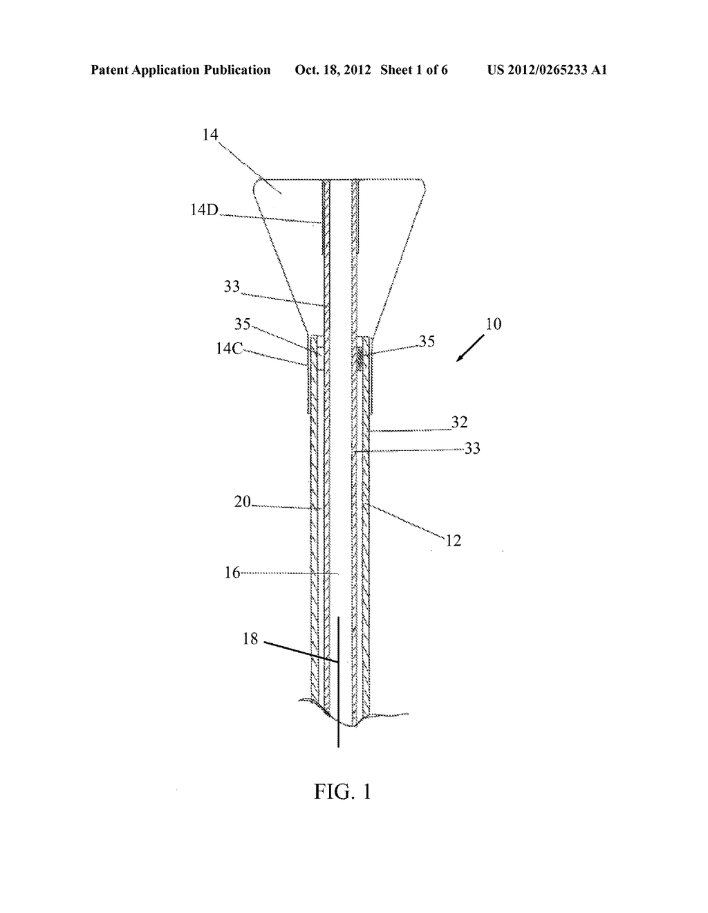 INVERTED BALLOON NECK ON CATHETER - diagram, schematic, and image 02