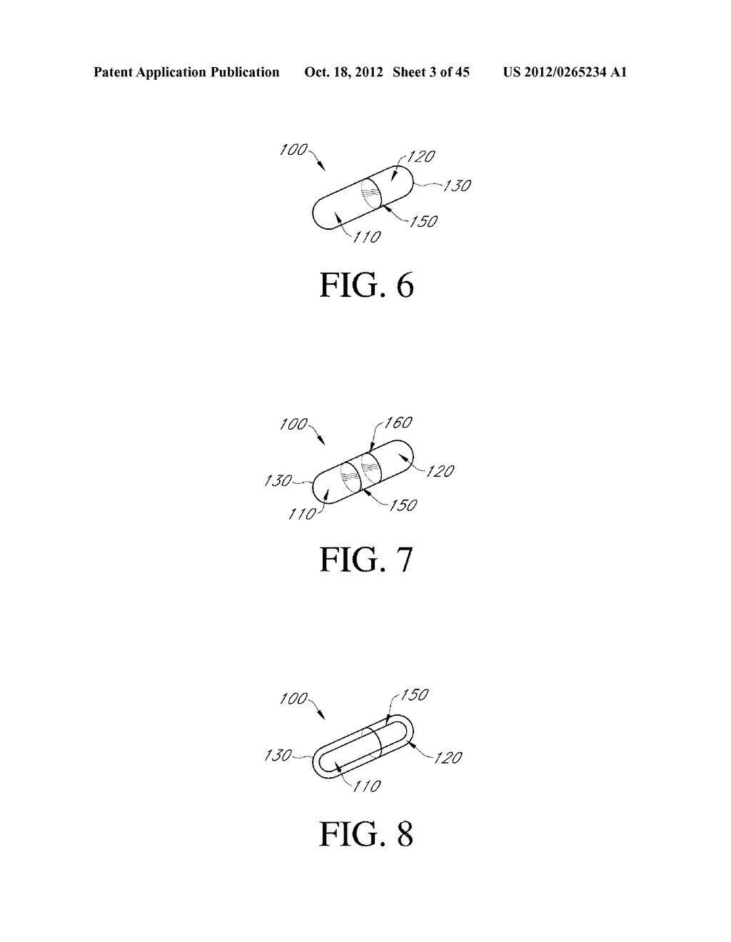 INTRAGASTRIC DEVICE - diagram, schematic, and image 04