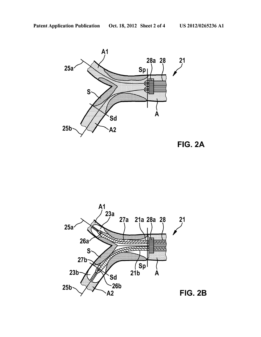 CATHETER DEVICE - diagram, schematic, and image 03