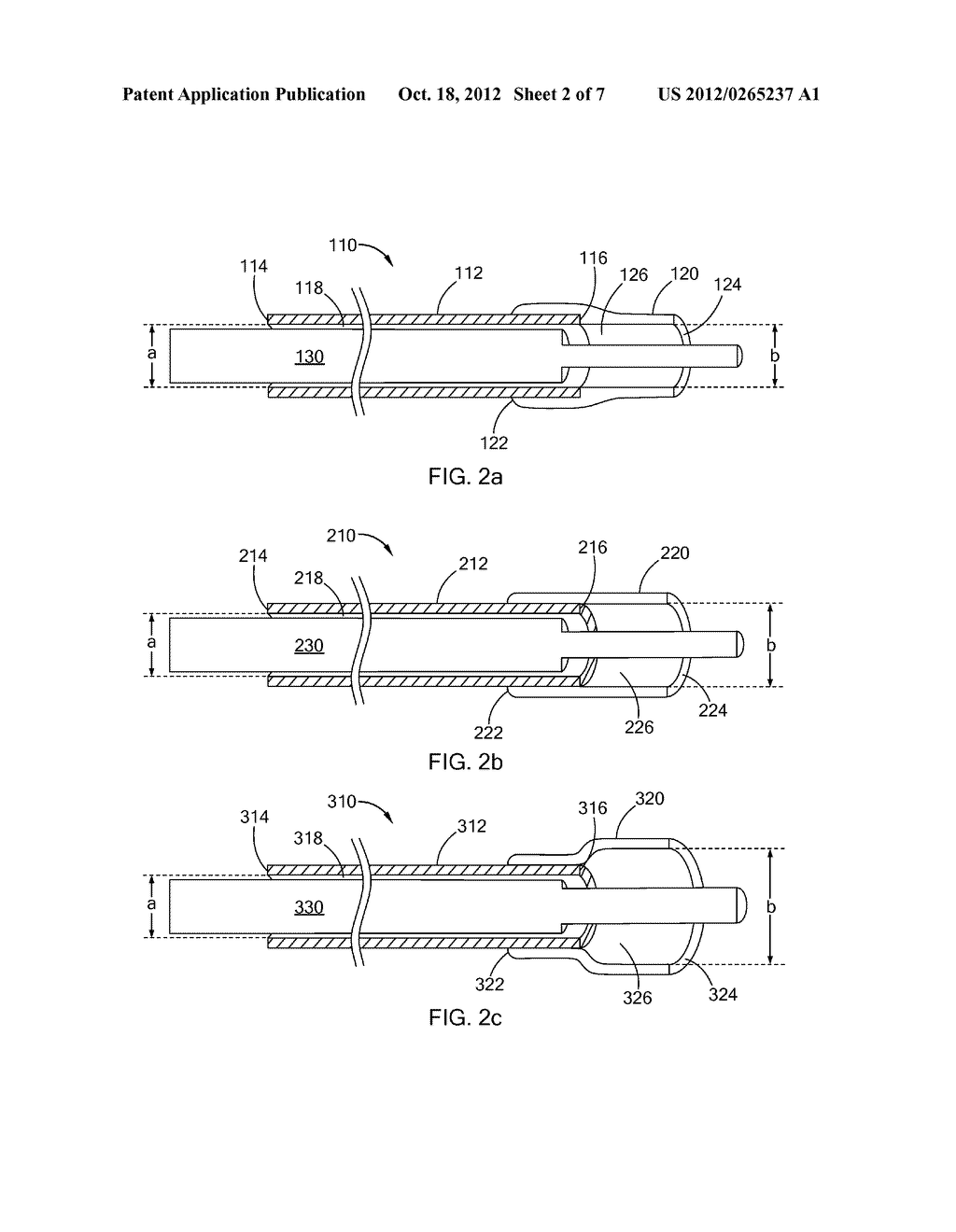 DETACHABLE EMBOLIZATION COIL SLEEVE - diagram, schematic, and image 03