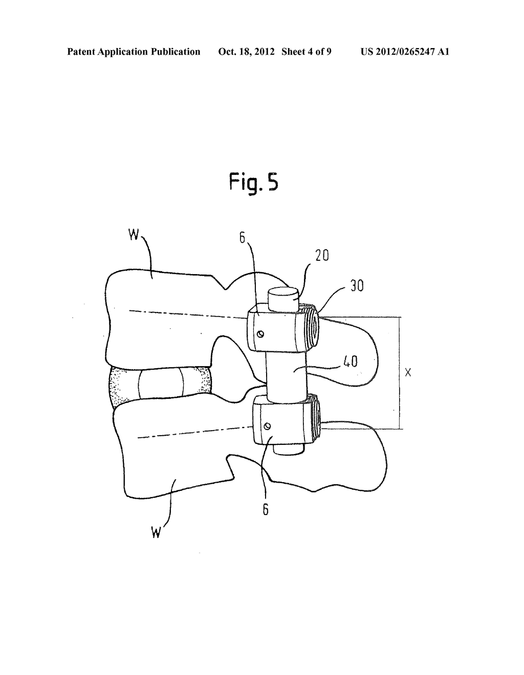 FLEXIBLE STABILIZATION DEVICE FOR DYNAMIC STABILIZATION OF BONES OR     VERTEBRAE - diagram, schematic, and image 05