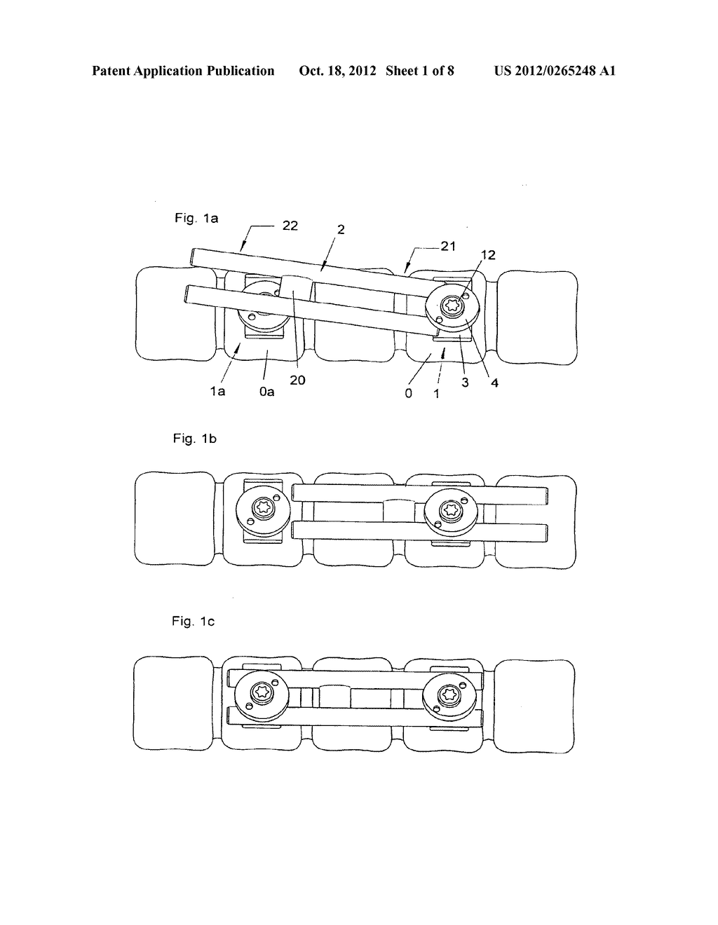 Plate for osteosynthesis device and method of preassembling such device - diagram, schematic, and image 02