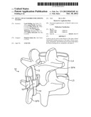 DEVICE AND ACCESSORIES FOR LIMITING FLEXION diagram and image