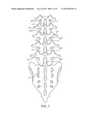 DEVICE AND ACCESSORIES FOR LIMITING FLEXION diagram and image