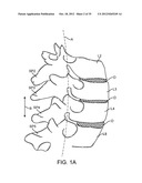 DEVICE AND ACCESSORIES FOR LIMITING FLEXION diagram and image