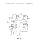 DEVICE AND ACCESSORIES FOR LIMITING FLEXION diagram and image