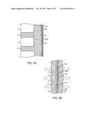 DEVICE AND ACCESSORIES FOR LIMITING FLEXION diagram and image