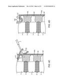 DEVICE AND ACCESSORIES FOR LIMITING FLEXION diagram and image