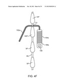 DEVICE AND ACCESSORIES FOR LIMITING FLEXION diagram and image