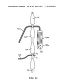 DEVICE AND ACCESSORIES FOR LIMITING FLEXION diagram and image