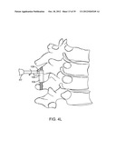 DEVICE AND ACCESSORIES FOR LIMITING FLEXION diagram and image