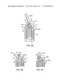 DEVICE AND ACCESSORIES FOR LIMITING FLEXION diagram and image