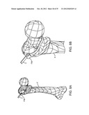 DEVICE AND ACCESSORIES FOR LIMITING FLEXION diagram and image