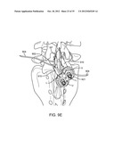 DEVICE AND ACCESSORIES FOR LIMITING FLEXION diagram and image