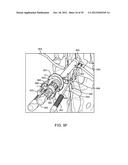 DEVICE AND ACCESSORIES FOR LIMITING FLEXION diagram and image