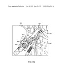 DEVICE AND ACCESSORIES FOR LIMITING FLEXION diagram and image