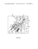 DEVICE AND ACCESSORIES FOR LIMITING FLEXION diagram and image