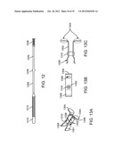 DEVICE AND ACCESSORIES FOR LIMITING FLEXION diagram and image