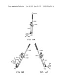 DEVICE AND ACCESSORIES FOR LIMITING FLEXION diagram and image