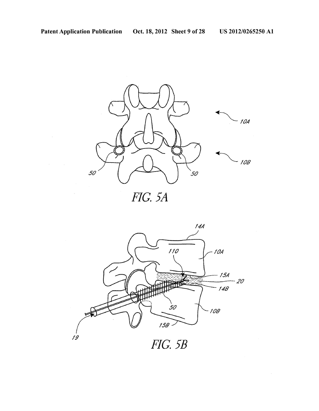 TRANSPEDICULAR ACCESS TO INTERVERTEBRAL SPACES AND RELATED SPINAL FUSION     SYSTEMS AND METHODS - diagram, schematic, and image 10