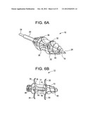 CONICAL INTERSPINOUS APPARATUS AND A METHOD OF PERFORMING INTERSPINOUS     DISTRACTION diagram and image