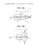 CONICAL INTERSPINOUS APPARATUS AND A METHOD OF PERFORMING INTERSPINOUS     DISTRACTION diagram and image