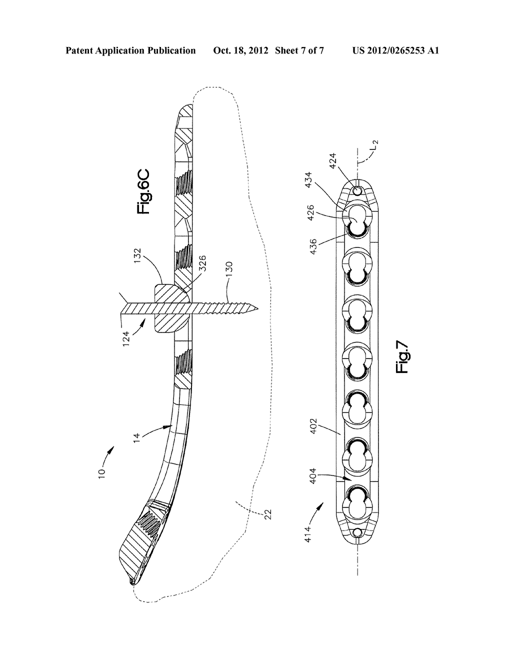 METHODS AND ASSEMBLIES FOR ALIGNING A BONE FIXATION PLATE - diagram, schematic, and image 08