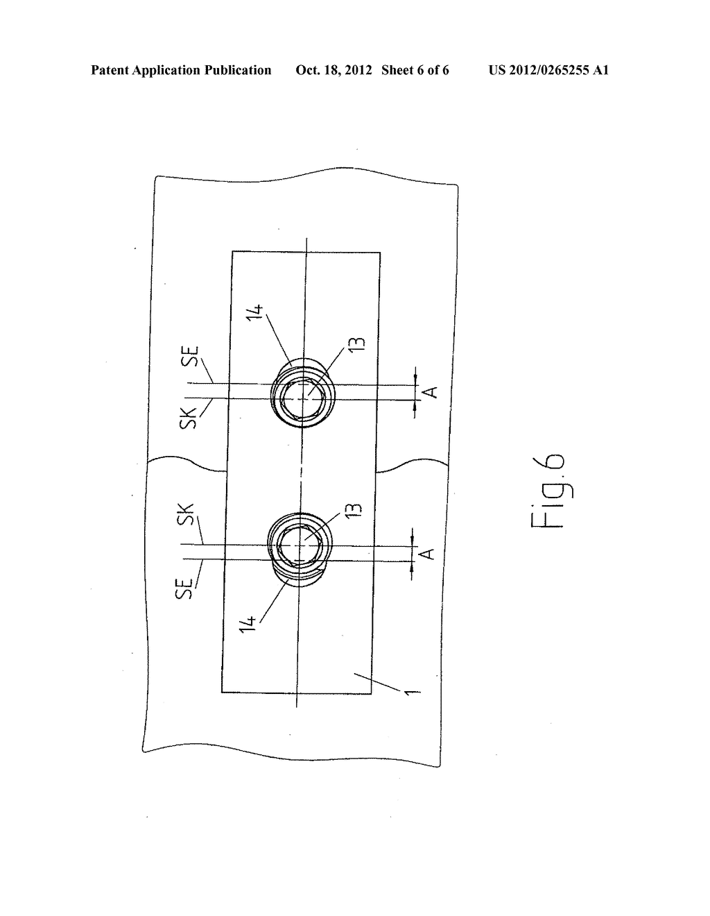 APPARATUS FOR THE CONSTANT-ANGLE FIXATION AND COMPRESSION OF A FRACTURE OR     OSTEOTOMY OF A BONE - diagram, schematic, and image 07