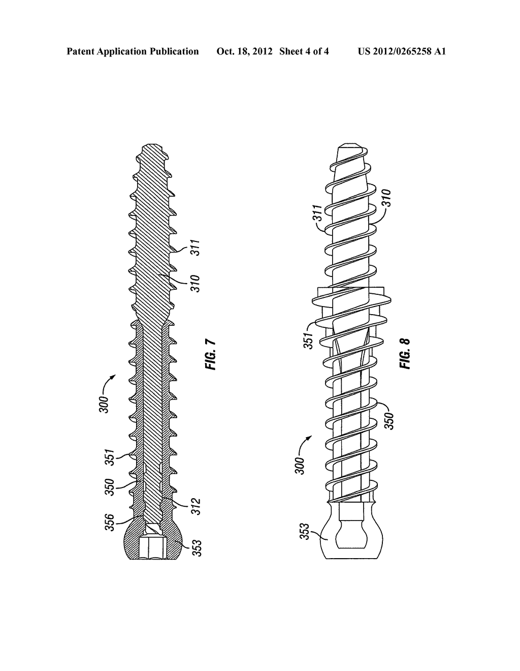 Expanding Spinal Anchor - diagram, schematic, and image 05