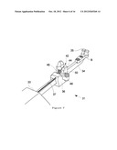 TIGHTENING DEVICE FOR BONE FASTENING CABLE diagram and image