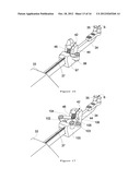 TIGHTENING DEVICE FOR BONE FASTENING CABLE diagram and image