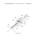 TIGHTENING DEVICE FOR BONE FASTENING CABLE diagram and image