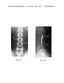 PROGRAMMING INTERFACE FOR SPINAL CORD NEUROMODULATION diagram and image