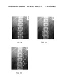 PROGRAMMING INTERFACE FOR SPINAL CORD NEUROMODULATION diagram and image