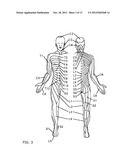 PROGRAMMING INTERFACE FOR SPINAL CORD NEUROMODULATION diagram and image