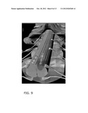 PROGRAMMING INTERFACE FOR SPINAL CORD NEUROMODULATION diagram and image