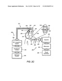 SYSTEMS AND METHODS FOR DETECTING AND USING AN ELECTRICAL COCHLEAR     RESPONSE ( ECR ) IN ANALYZING OPERATION OF A COCHLEAR STIMULATION SYSTEM diagram and image