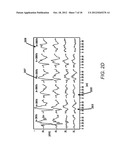 SYSTEMS AND METHODS FOR DETECTING AND USING AN ELECTRICAL COCHLEAR     RESPONSE ( ECR ) IN ANALYZING OPERATION OF A COCHLEAR STIMULATION SYSTEM diagram and image