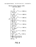 SYSTEMS AND METHODS FOR DETECTING AND USING AN ELECTRICAL COCHLEAR     RESPONSE ( ECR ) IN ANALYZING OPERATION OF A COCHLEAR STIMULATION SYSTEM diagram and image