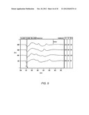 SYSTEMS AND METHODS FOR DETECTING AND USING AN ELECTRICAL COCHLEAR     RESPONSE ( ECR ) IN ANALYZING OPERATION OF A COCHLEAR STIMULATION SYSTEM diagram and image