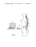 SENSING DEVICE FOR INDICATING POSTURE OF PATIENT IMPLANTED WITH A     NEUROSTIMULATION DEVICE diagram and image