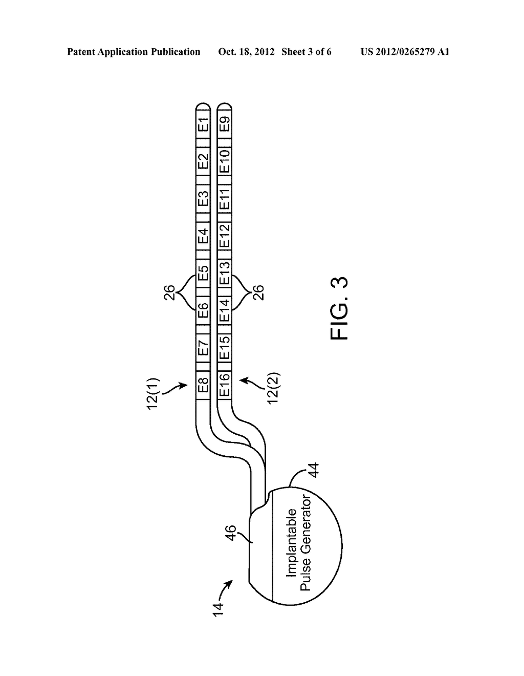 SENSING DEVICE FOR INDICATING POSTURE OF PATIENT IMPLANTED WITH A     NEUROSTIMULATION DEVICE - diagram, schematic, and image 04