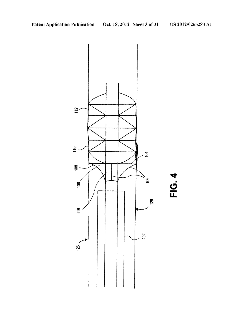 REPERFUSION INJURY DEVICES - diagram, schematic, and image 04